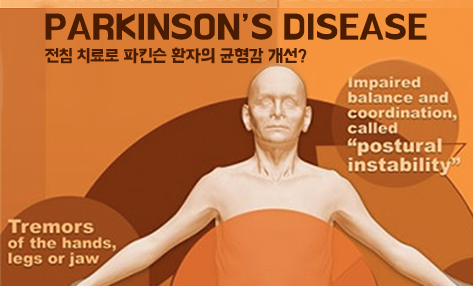 [EBM77] 전침 파킨슨 균형감 공병희.jpg