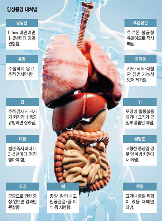 양성종양 01_520.jpg