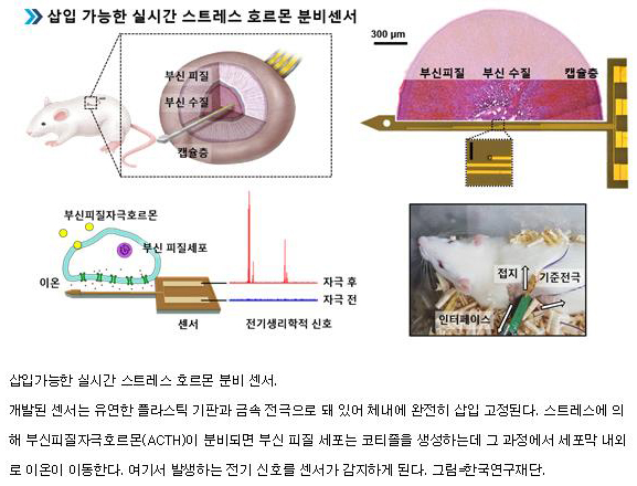 코티졸 02.jpg