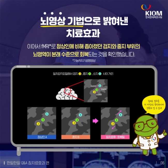 한알한알_QA_침치료효과-2차-06.jpg