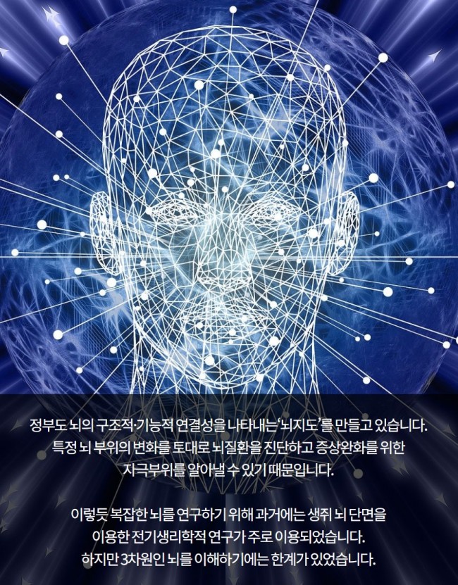 브레인칩4.jpg