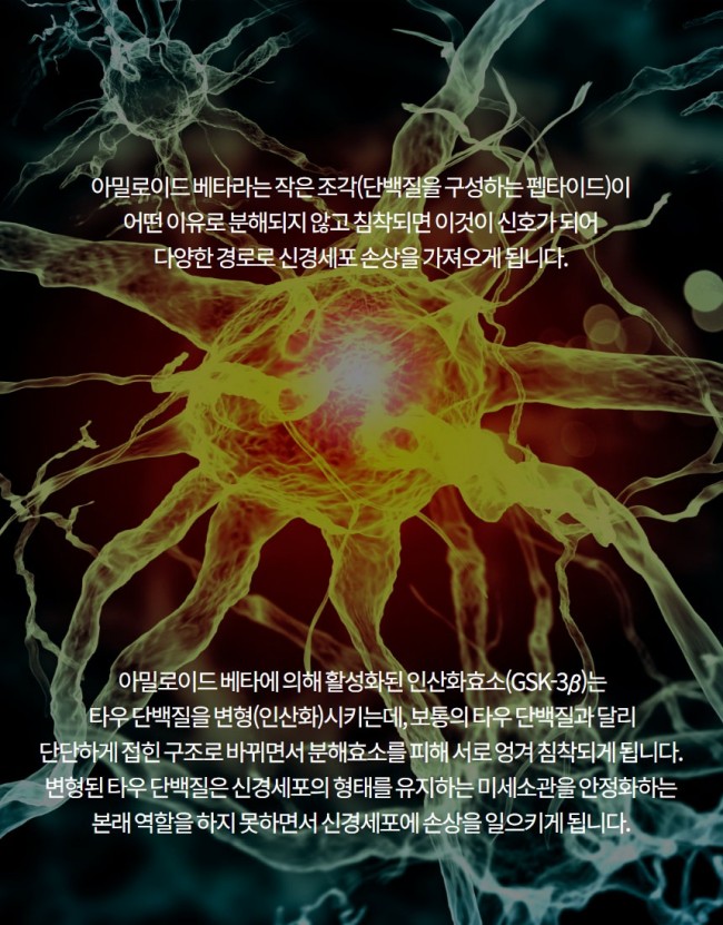 치매4.jpg