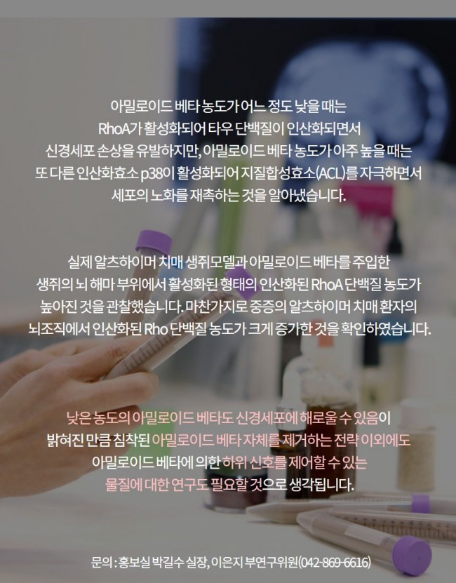 치매6.jpg