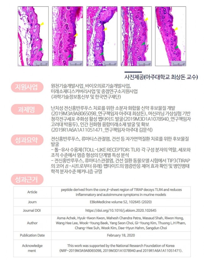 염증8.jpg