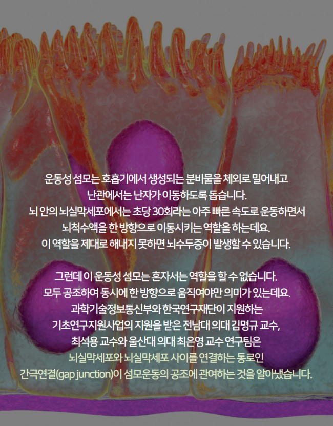 뇌4.jpg