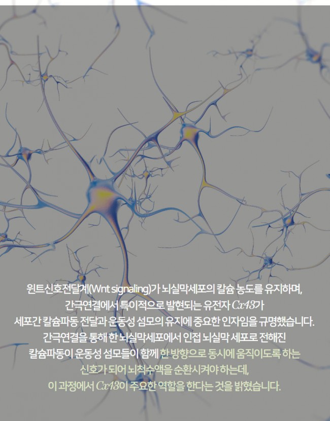 뇌5.jpg
