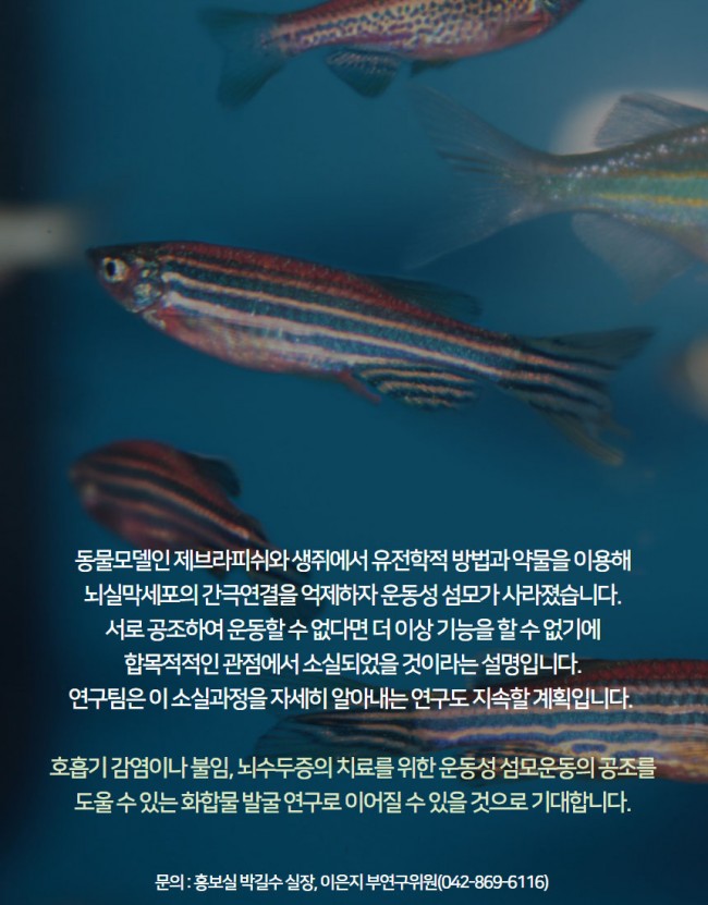 뇌6.jpg