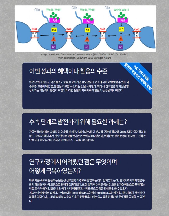 뇌8.jpg