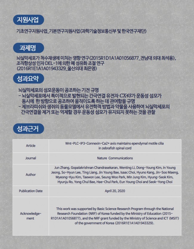 뇌9.jpg