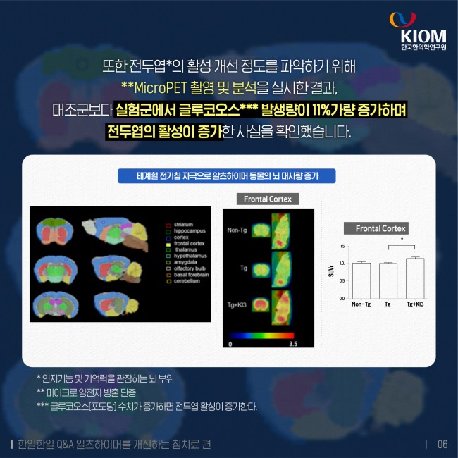 한알한알-알츠하이머-4차-06.jpg