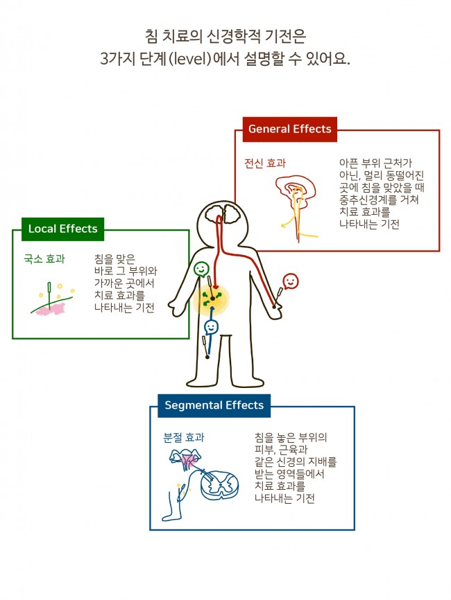 침술의 기전 1편_page-0005.jpg