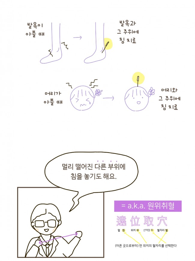 침술편 new 1-1_page-0004.jpg