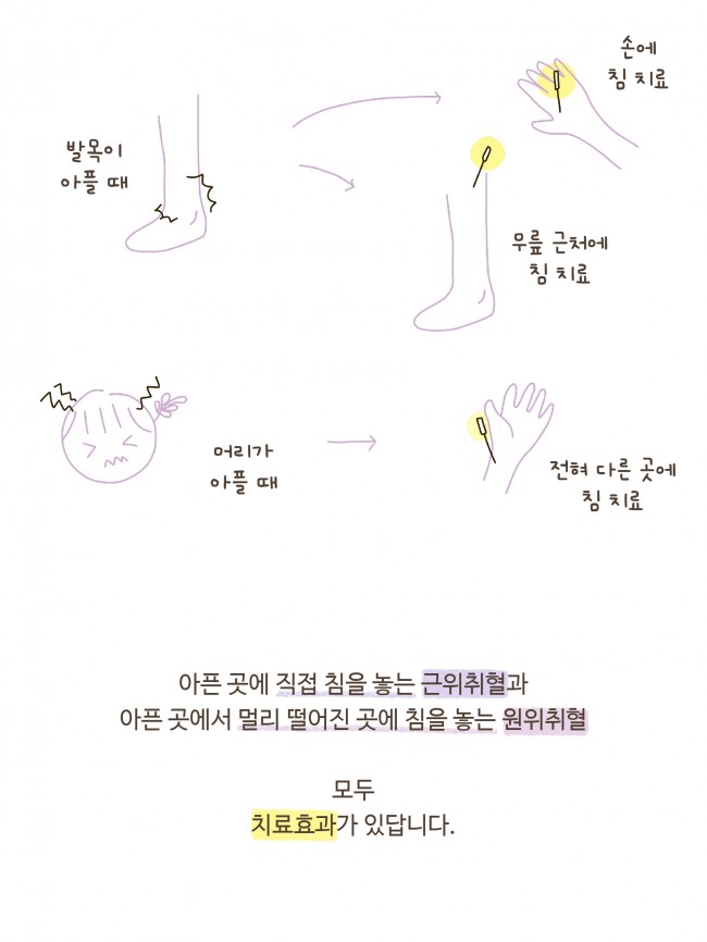 침술편 new 1-1_page-0005.jpg