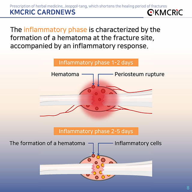 0072 cardnews-골절 치료 기간을 단축하는 접골탕 한약 처방-영어_페이지_08.jpg