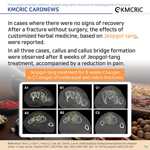 0072 cardnews-골절 치료 기간을 단축하는 접골탕 한약 처방-영어_페이지_14.jpg